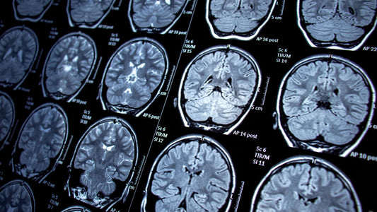 How 15 Minutes Rewires Your Brain: The Neuroscience of Journaling